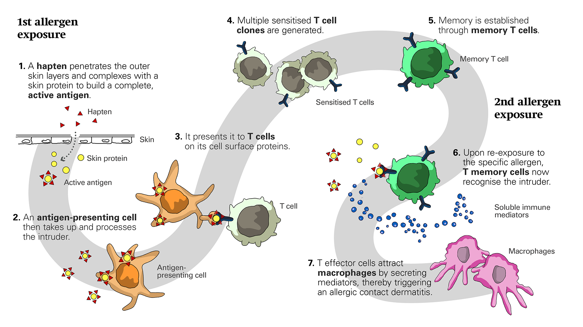 Mechanisms of contact dermatitis and eczema